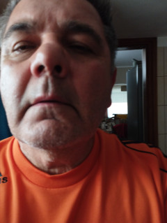 millis csaba 2. további képe